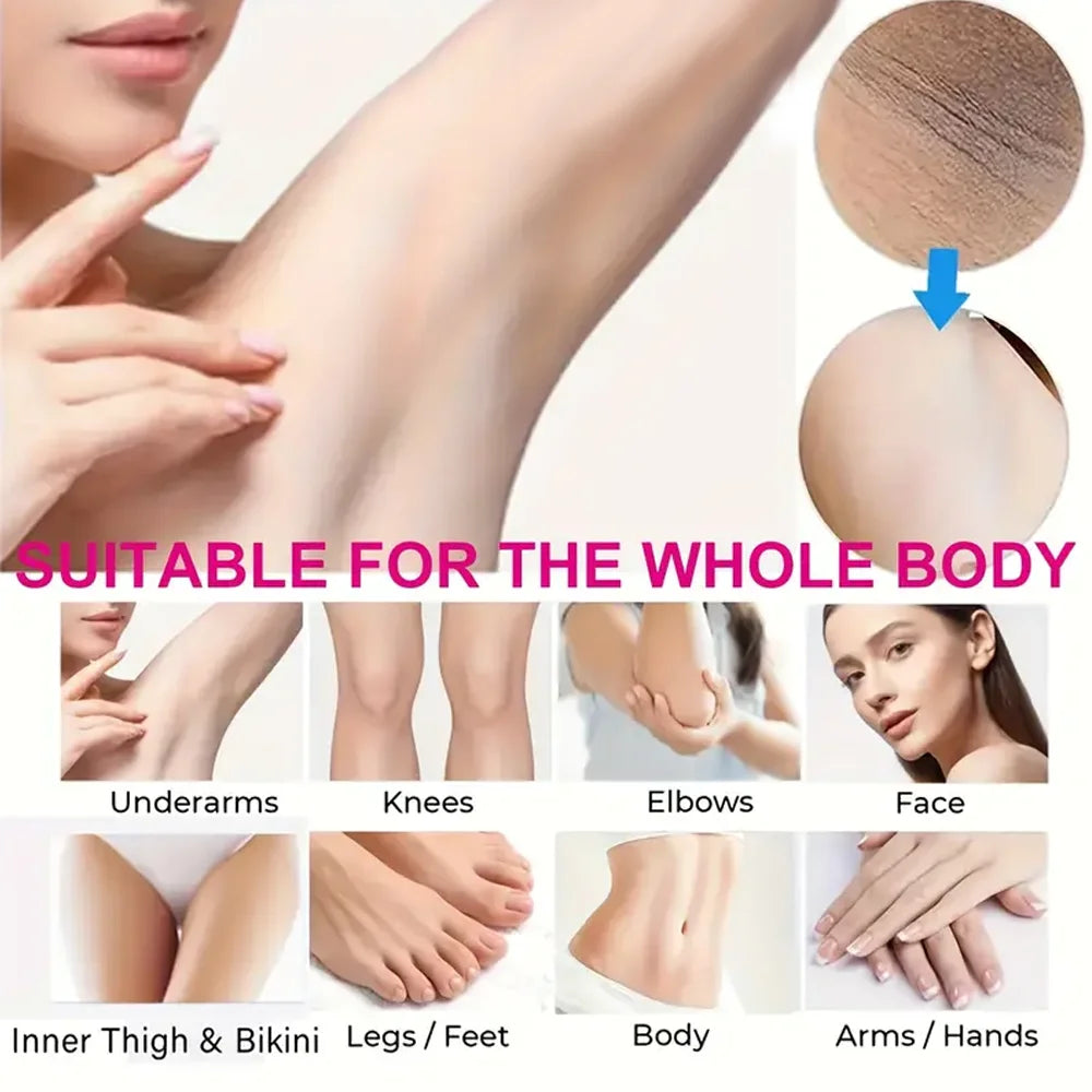 Crème hydratante pour le corps, blanchissante, pour les aisselles, pour les fesses et les genoux, parties intimes, mélanine, éclaircissante, soins pour la peau foncée, beauté pour femmes