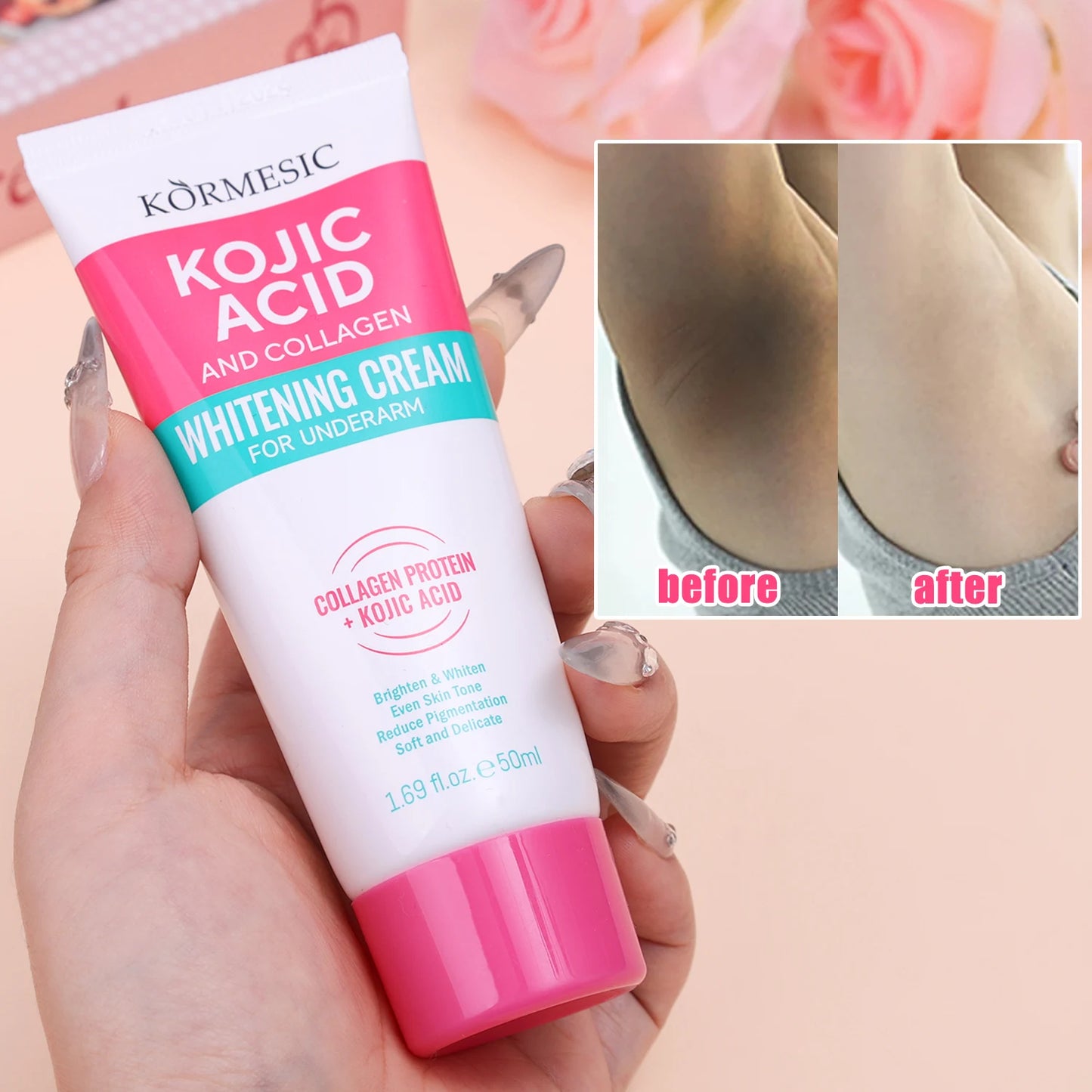 Crème hydratante pour le corps, blanchissante, pour les aisselles, pour les fesses et les genoux, parties intimes, mélanine, éclaircissante, soins pour la peau foncée, beauté pour femmes