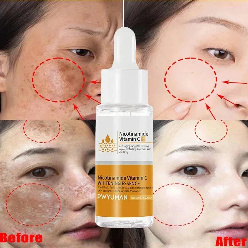 Injuste-Sérum blanchissant pour le visage, élimine les taches foncées et les taches de rousseur, correcteur de mélanine, anti-pigmentation, éclaircit la peau, produits de soins de beauté