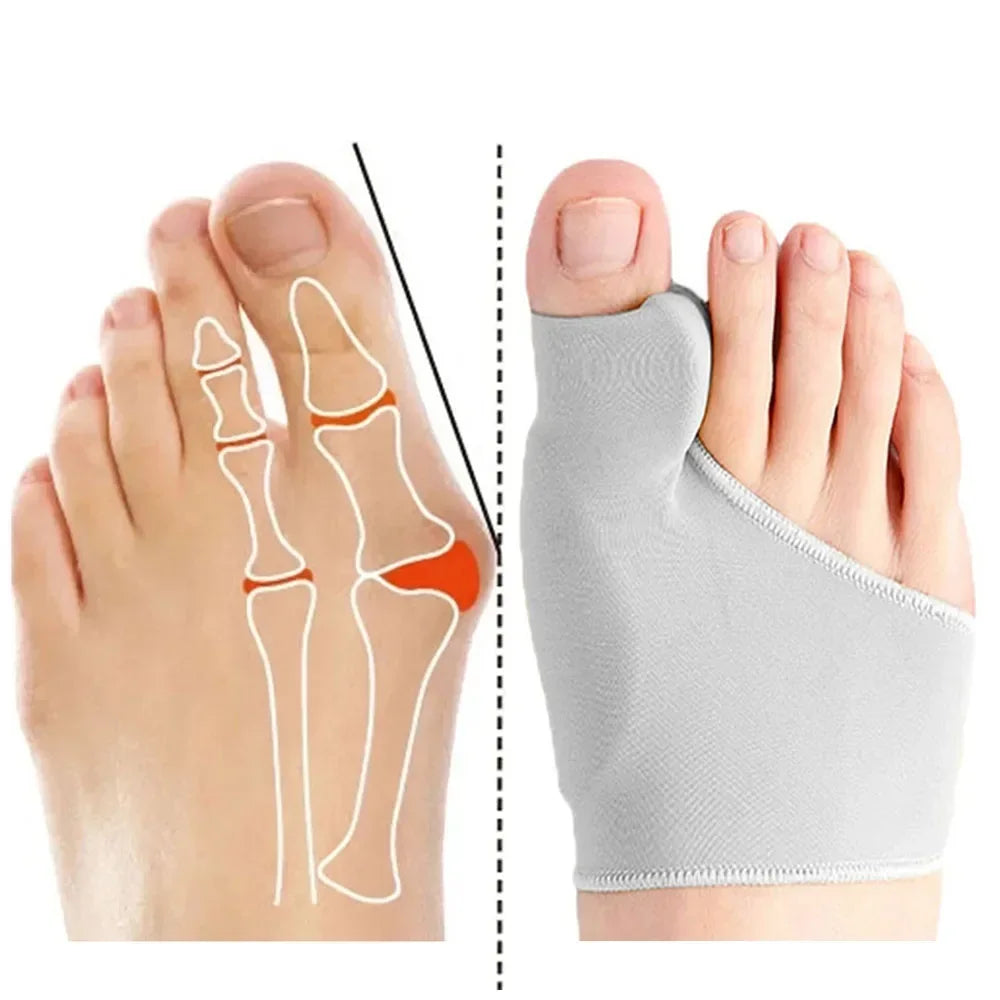 Correcteur d'oignon, séparateur d'orteils pour la relaxation des gros orteils, épurée et étirement pour Hallux Valgus et soutien des oignons, protecteur pour gros orteils