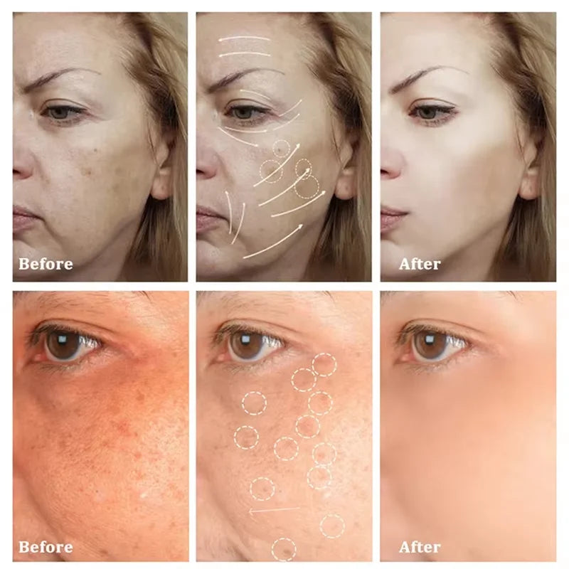 Injuste-Sérum blanchissant pour le visage, élimine les taches foncées et les taches de rousseur, correcteur de mélanine, anti-pigmentation, éclaircit la peau, produits de soins de beauté