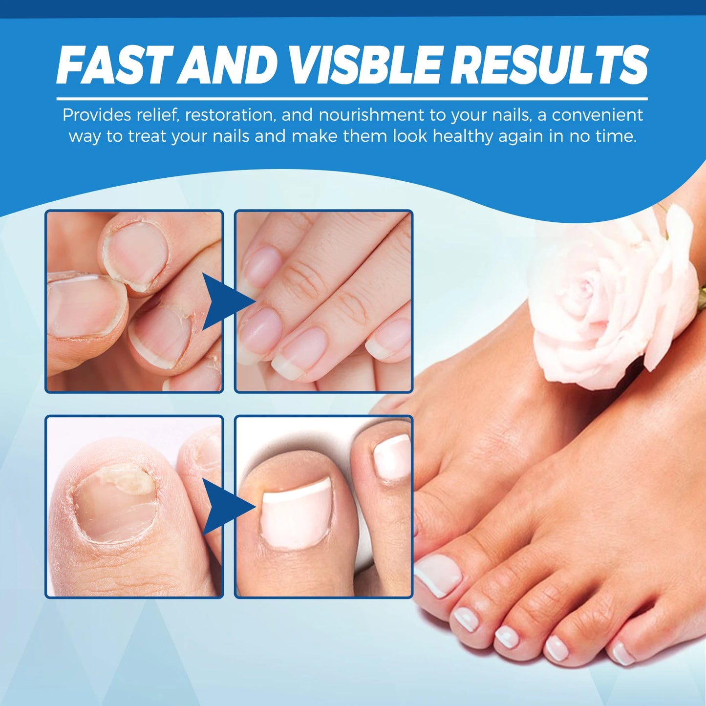 Stylo Laser pour le corps sain, outil de soins des pieds des jambes pour vous entretenir le bien-être optimal