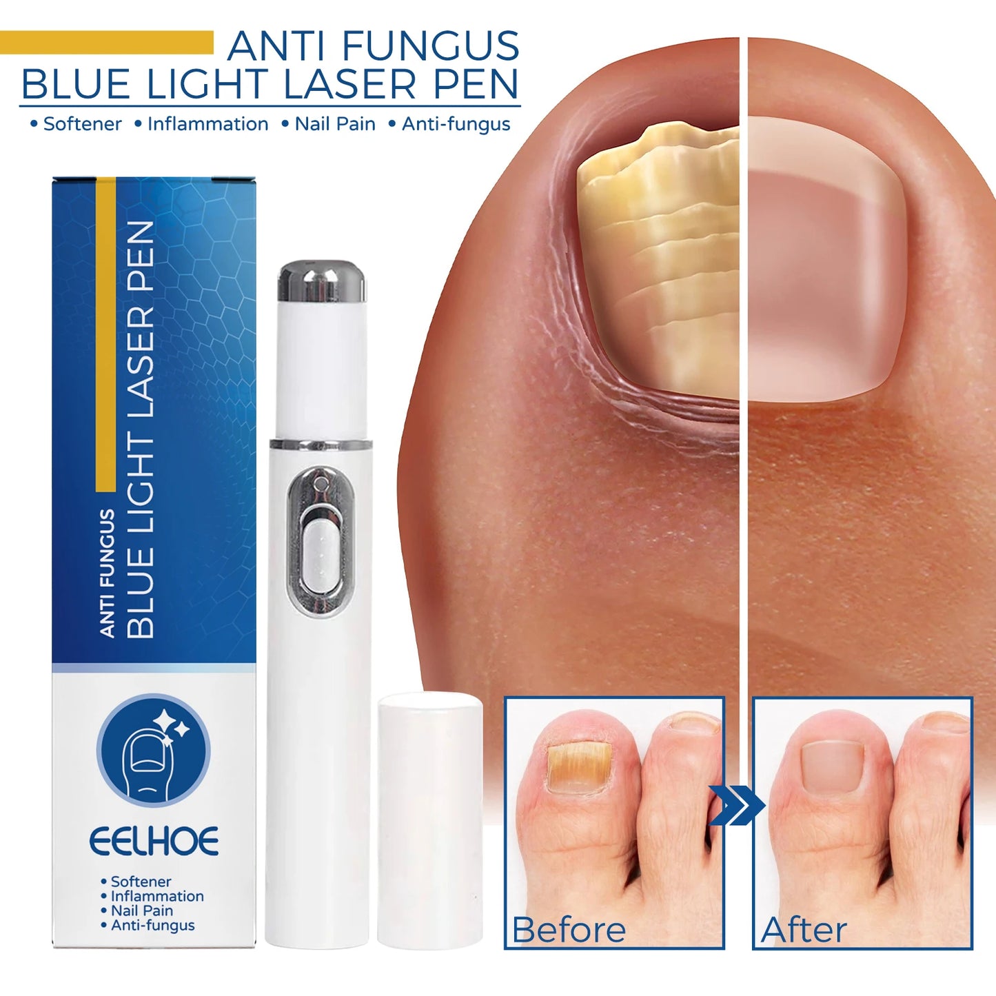 Stylo Laser pour le corps sain, outil de soins des pieds des jambes pour vous entretenir le bien-être optimal
