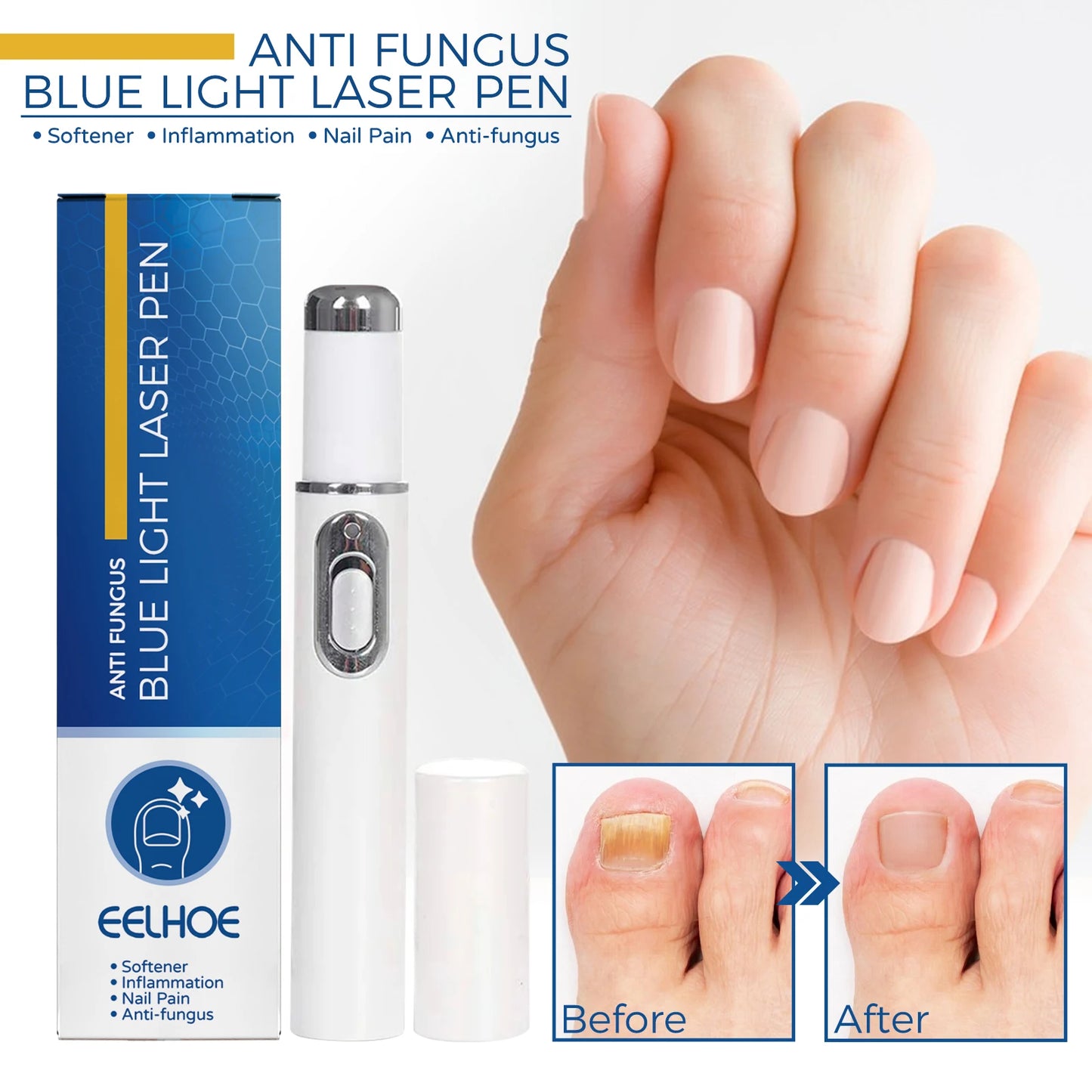 Stylo Laser pour le corps sain, outil de soins des pieds des jambes pour vous entretenir le bien-être optimal