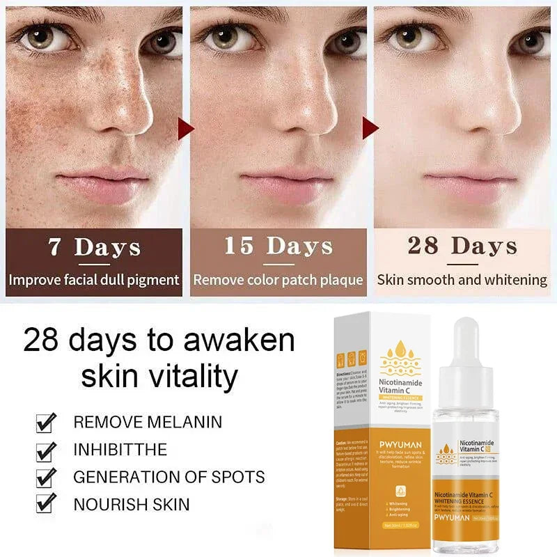 Injuste-Sérum blanchissant pour le visage, élimine les taches foncées et les taches de rousseur, correcteur de mélanine, anti-pigmentation, éclaircit la peau, produits de soins de beauté