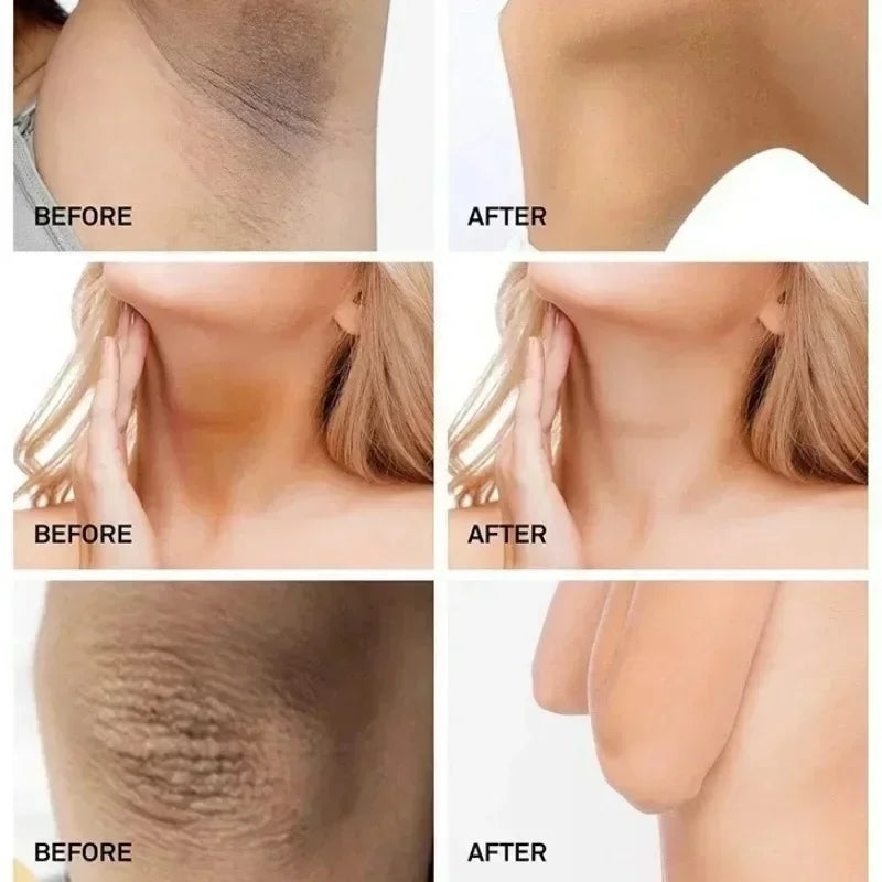 Crème hydratante pour le corps, blanchissante, pour les aisselles, pour les fesses et les genoux, parties intimes, mélanine, éclaircissante, soins pour la peau foncée, beauté pour femmes
