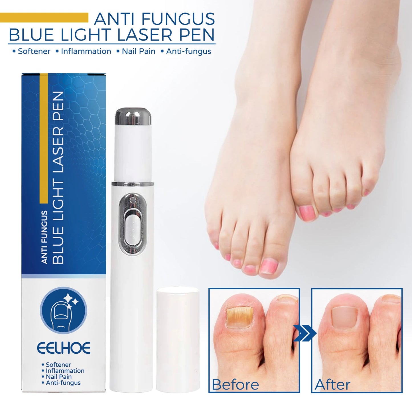 Stylo Laser pour le corps sain, outil de soins des pieds des jambes pour vous entretenir le bien-être optimal