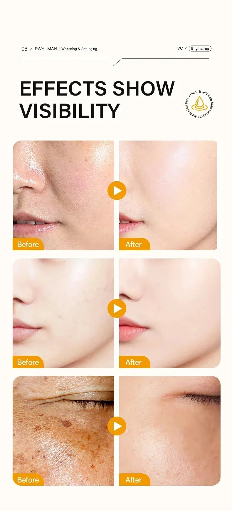 Injuste-Sérum blanchissant pour le visage, élimine les taches foncées et les taches de rousseur, correcteur de mélanine, anti-pigmentation, éclaircit la peau, produits de soins de beauté