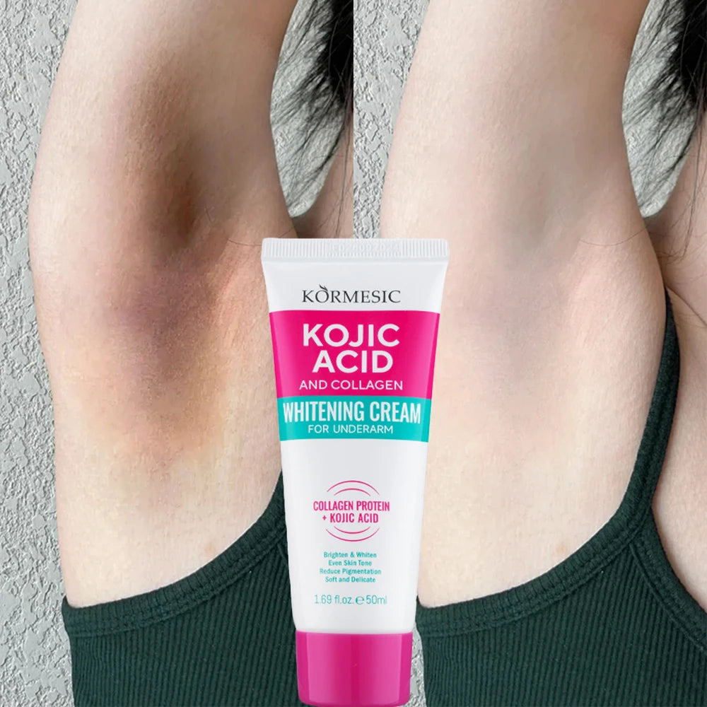 Crème hydratante pour le corps, blanchissante, pour les aisselles, pour les fesses et les genoux, parties intimes, mélanine, éclaircissante, soins pour la peau foncée, beauté pour femmes