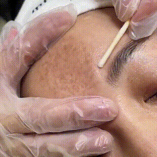 Injuste-Sérum blanchissant pour le visage, élimine les taches foncées et les taches de rousseur, correcteur de mélanine, anti-pigmentation, éclaircit la peau, produits de soins de beauté