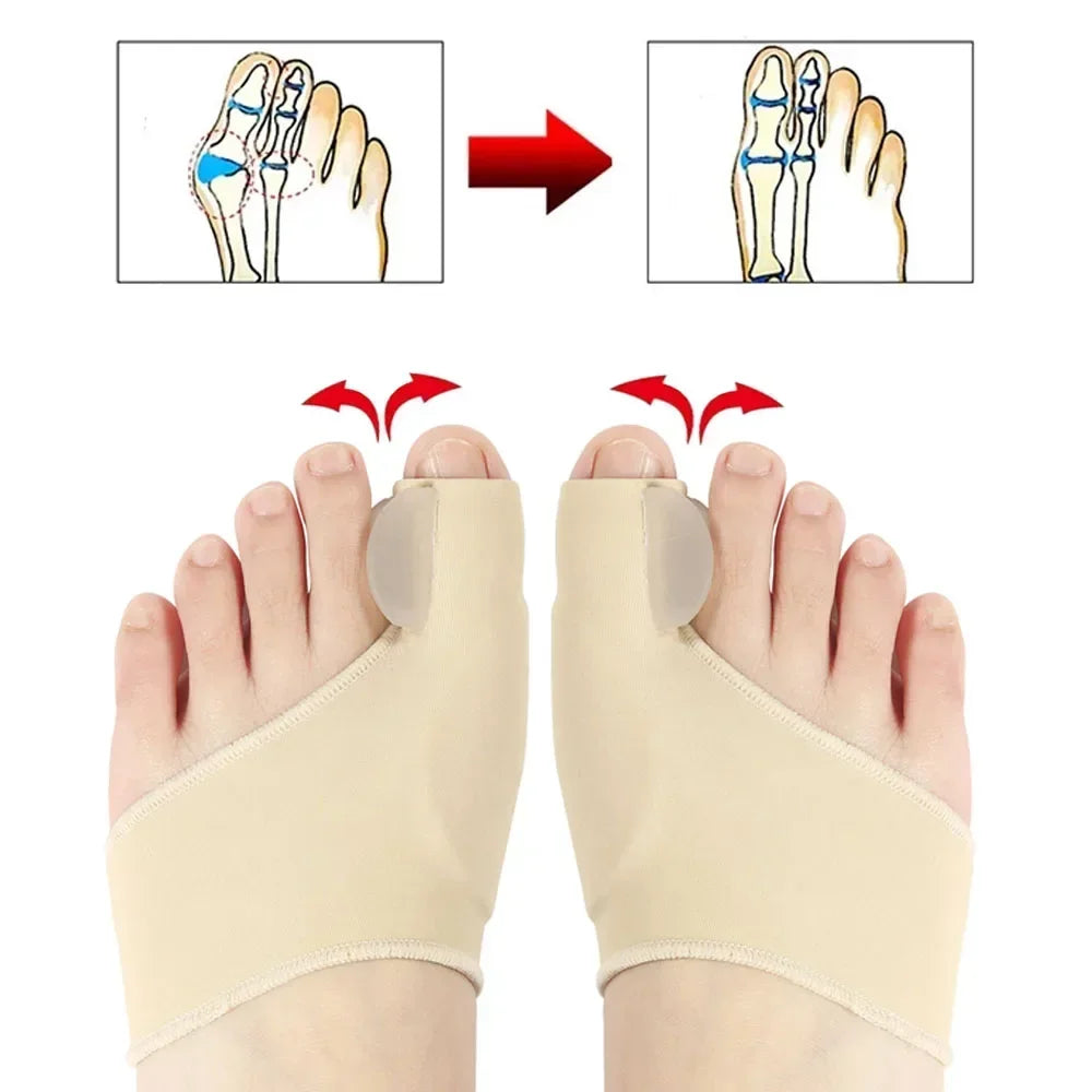 Correcteur d'oignon, séparateur d'orteils pour la relaxation des gros orteils, épurée et étirement pour Hallux Valgus et soutien des oignons, protecteur pour gros orteils