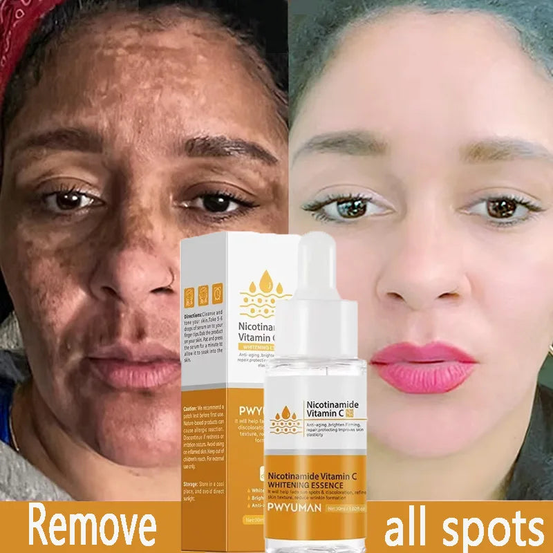 Injuste-Sérum blanchissant pour le visage, élimine les taches foncées et les taches de rousseur, correcteur de mélanine, anti-pigmentation, éclaircit la peau, produits de soins de beauté