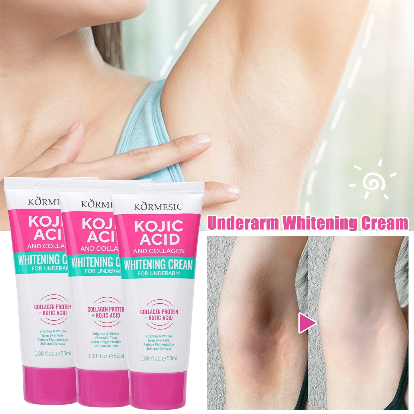 Crème hydratante pour le corps, blanchissante, pour les aisselles, pour les fesses et les genoux, parties intimes, mélanine, éclaircissante, soins pour la peau foncée, beauté pour femmes