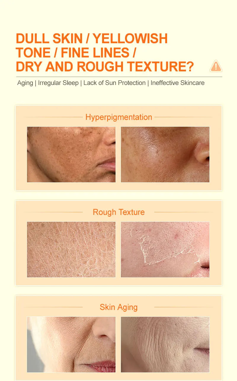 Ensemble de soins pour la peau du visage blanchissant à la vitamine C, dissolvant de taches foncées, crème pour le visage 50ML et Kit de sérum pour le visage 30G, cosmétique Anti-rides