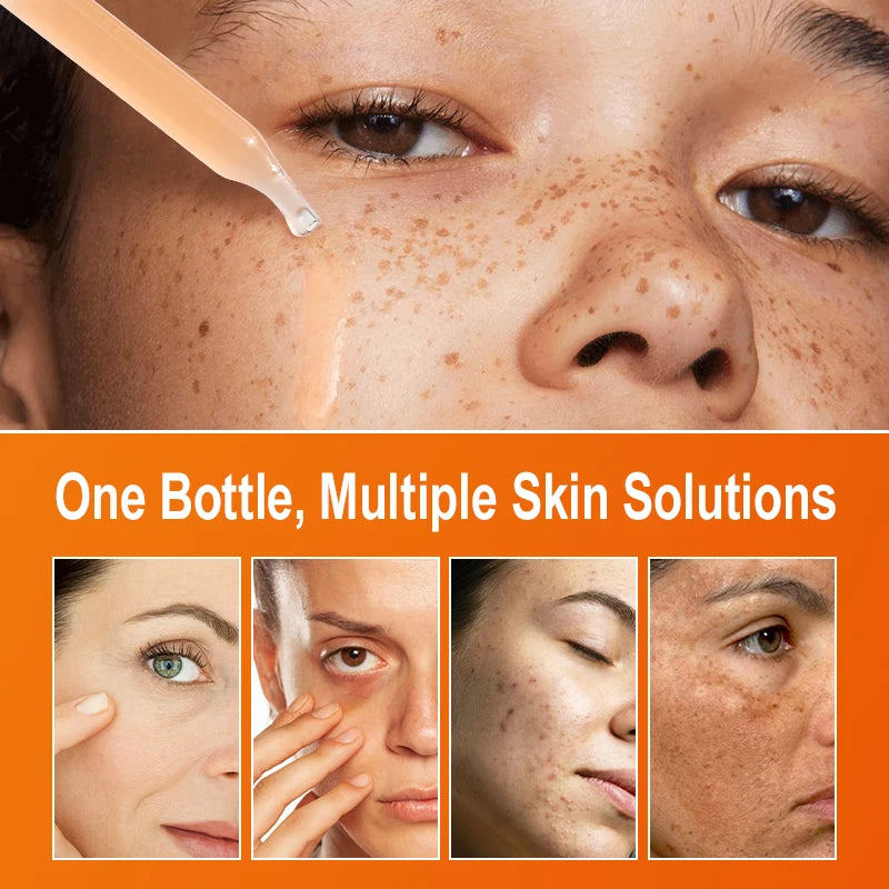 Sérum pour le visage à la vitamine C, blanchissant, élimination des taches foncées, acide hyaluronique, Essence pour le visage, produits de soins pour la peau, 30ML
